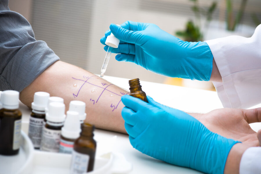 Especialidade: Alergia e Imunologia