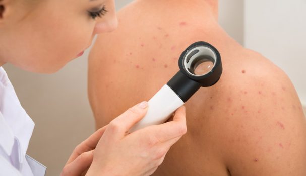 Especialidade: Dermatologia